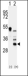 Anti-Apolipoprotein D antibody, N-term used in Western Blot (WB). GTX81463