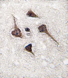 Anti-CaMKII alpha antibody, C-term used in IHC (Paraffin sections) (IHC-P). GTX81466