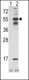 Anti-CaMKII alpha antibody, C-term used in Western Blot (WB). GTX81466