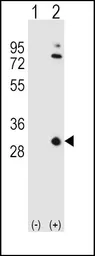Anti-Apolipoprotein A1 antibody, N-term used in Western Blot (WB). GTX81467