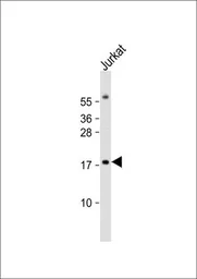 Anti-RBM3 antibody, Internal used in Western Blot (WB). GTX81472