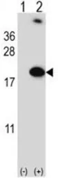 Anti-RBM3 antibody, Internal used in Western Blot (WB). GTX81472