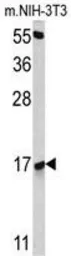 Anti-RBM3 antibody, Internal used in Western Blot (WB). GTX81472