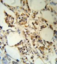 Anti-RBM3 antibody, C-term used in IHC (Paraffin sections) (IHC-P). GTX81473