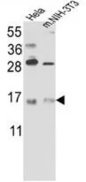 Anti-RBM3 antibody, C-term used in Western Blot (WB). GTX81473
