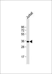 Anti-FBP1 antibody, N-term used in Western Blot (WB). GTX81483