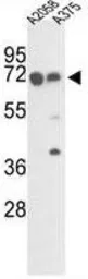 Anti-FKBP10 antibody, C-term used in Western Blot (WB). GTX81486