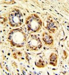 Anti-Cathepsin K antibody, Internal used in IHC (Paraffin sections) (IHC-P). GTX81488