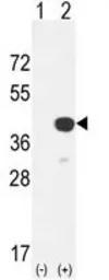 Anti-Cathepsin K antibody, Internal used in Western Blot (WB). GTX81488