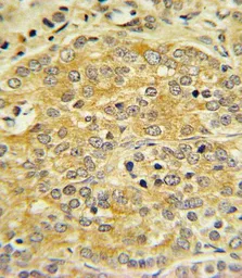Anti-Apolipoprotein L1 antibody, C-term used in IHC (Paraffin sections) (IHC-P). GTX81504