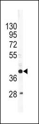 Anti-Apolipoprotein L1 antibody, C-term used in Western Blot (WB). GTX81504
