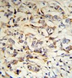 Anti-CPN2 antibody, N-term used in IHC (Paraffin sections) (IHC-P). GTX81514