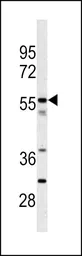 Anti-CPN2 antibody, N-term used in Western Blot (WB). GTX81514