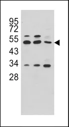 Anti-CPA4 antibody, C-term used in Western Blot (WB). GTX81517