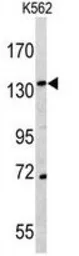 Anti-CD163 antibody, N-term used in Western Blot (WB). GTX81526