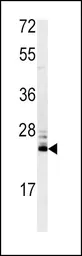 Anti-MSRA antibody, N-term used in Western Blot (WB). GTX81531