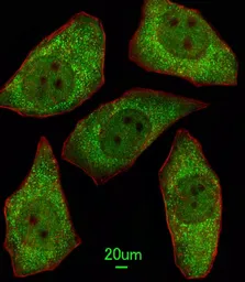 Anti-MSRA antibody, N-term used in Immunocytochemistry/ Immunofluorescence (ICC/IF). GTX81531