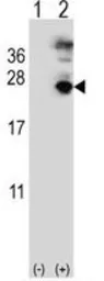 Anti-MFAP5 antibody, C-term used in Western Blot (WB). GTX81533