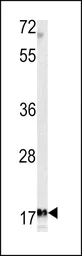 Anti-MFAP5 antibody, C-term used in Western Blot (WB). GTX81533