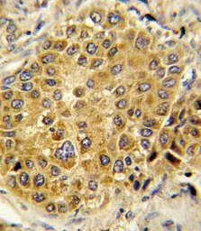 Anti-PLG antibody, C-term used in IHC (Paraffin sections) (IHC-P). GTX81534