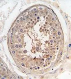 Anti-JLP antibody, Internal used in IHC (Paraffin sections) (IHC-P). GTX81547