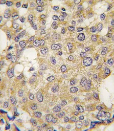 Anti-PARG antibody, C-term used in IHC (Paraffin sections) (IHC-P). GTX81550