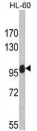 Anti-NLRP12 antibody used in Western Blot (WB). GTX81551