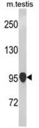 Anti-NLRP12 antibody used in Western Blot (WB). GTX81551