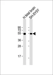 Anti-EN1 antibody, N-term used in Western Blot (WB). GTX81554
