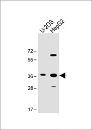 Anti-EN1 antibody, N-term used in Western Blot (WB). GTX81554