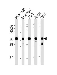 Anti-EN1 antibody, N-term used in Western Blot (WB). GTX81554