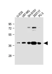 Anti-EN1 antibody, N-term used in Western Blot (WB). GTX81554