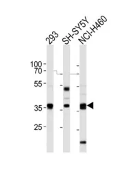 Anti-EN1 antibody, N-term used in Western Blot (WB). GTX81554