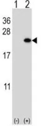 Anti-BarX1 antibody, C-term used in Western Blot (WB). GTX81557