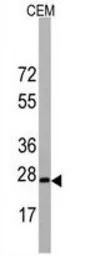 Anti-BarX1 antibody, C-term used in Western Blot (WB). GTX81557