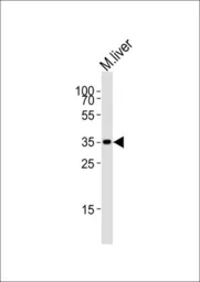 Anti-HMX2 antibody, C-term used in Western Blot (WB). GTX81571