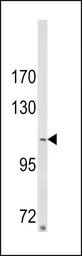 Anti-ARGBP2 antibody, N-term used in Western Blot (WB). GTX81600