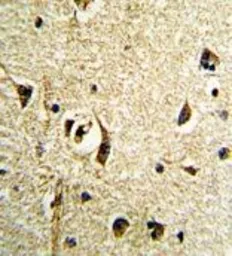 Anti-FTO antibody, N-term used in IHC (Paraffin sections) (IHC-P). GTX81611