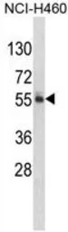 Anti-FTO antibody, N-term used in Western Blot (WB). GTX81611