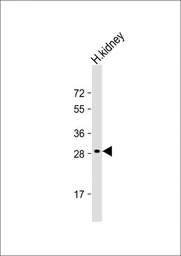 Anti-DIO1 antibody, N-term used in Western Blot (WB). GTX81625