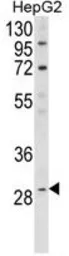 Anti-DIO1 antibody, N-term used in Western Blot (WB). GTX81625