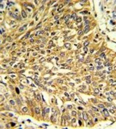 Anti-RGP1 antibody, C-term used in IHC (Paraffin sections) (IHC-P). GTX81626