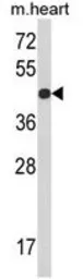 Anti-RGP1 antibody, C-term used in Western Blot (WB). GTX81626
