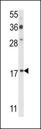 Anti-PDRG1 antibody, N-term used in Western Blot (WB). GTX81627