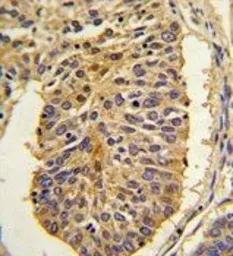 Anti-CER1 antibody, N-term used in IHC (Paraffin sections) (IHC-P). GTX81632