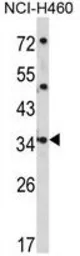 Anti-CER1 antibody, N-term used in Western Blot (WB). GTX81632