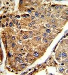 Anti-HEXA antibody, Internal used in IHC (Paraffin sections) (IHC-P). GTX81637