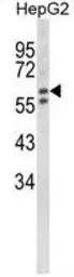 Anti-HEXA antibody, Internal used in Western Blot (WB). GTX81637