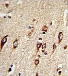 Anti-HEXA antibody, N-term used in IHC (Paraffin sections) (IHC-P). GTX81638