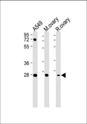 Anti-IGFBP4 antibody, N-term used in Western Blot (WB). GTX81639